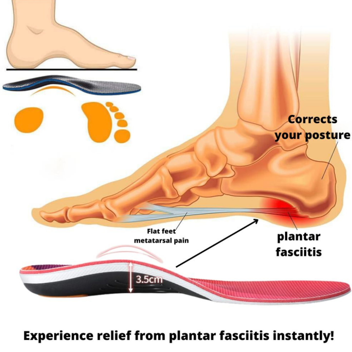 Orthopedic Foot Insoles
